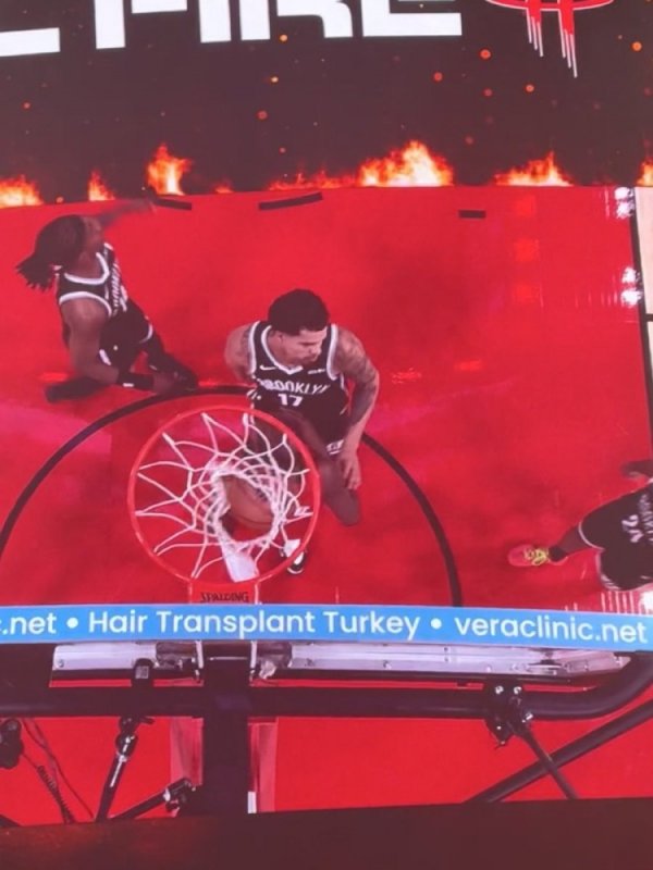 Hỏi James cái gì! Có một quảng cáo cho một công ty cấy tóc Thổ Nhĩ Kỳ ở mép trên của bảng rổ NBA. Hư